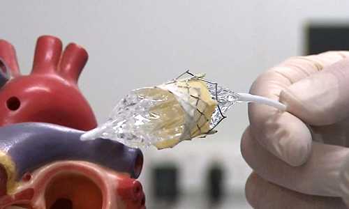 Dementia becomes Australia leading killer in a shocking new milestone