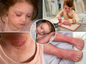 Tearing Her Skin Apart 1 Shocking Crisis Hits Sydney Family Hard